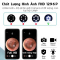 Dụng cụ lấy ráy tai gắn camera, đầu kim loại bọc silicone tiện lợi 