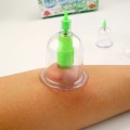 Bộ giác hơi hút chân không 12 ly không dùng lửa
