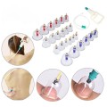 Bộ giác hơi không dùng lửa 24 ống giác tiện lợi dễ sử dụng