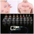 Bộ giác hơi không dùng lửa 24 ống giác tiện lợi dễ sử dụng
