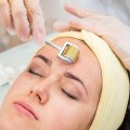 Cây lăn kim mặt cầm tay chuyên dụng tại nhà